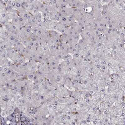 Immunohistochemistry-Paraffin: RABGAP1 Antibody [NBP2-56581]