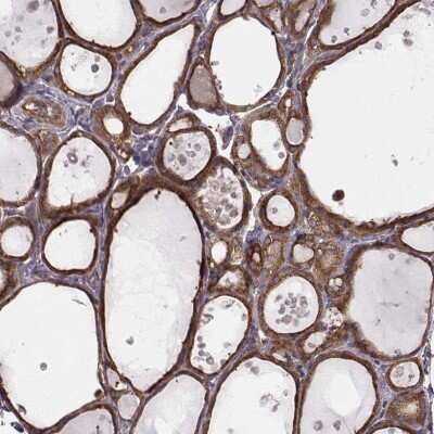 Immunohistochemistry-Paraffin: RABGAP1 Antibody [NBP2-56581]