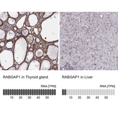 Immunohistochemistry-Paraffin: RABGAP1 Antibody [NBP2-56581]