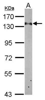 Western Blot: RABGAP1 Antibody [NBP2-15086]