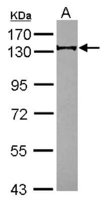 Western Blot: RABGAP1 Antibody [NBP2-15086]