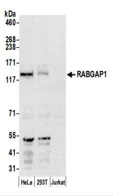 Western Blot: RABGAP1 Antibody [NBP2-44284]