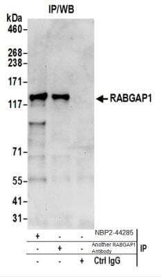 Western Blot: RABGAP1 Antibody [NBP2-44285]