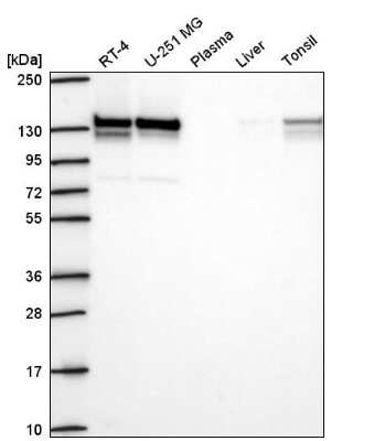 Western Blot: RABGAP1 Antibody [NBP2-56581]