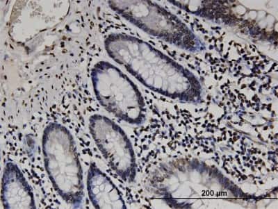 Immunohistochemistry-Paraffin: RABGAP1L Antibody (2D3) [H00009910-M05]