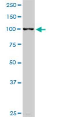 Western Blot: RABGAP1L Antibody (2D3) [H00009910-M05]