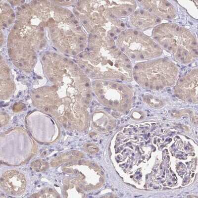 Immunohistochemistry-Paraffin: RABGAP1L Antibody [NBP2-31582]