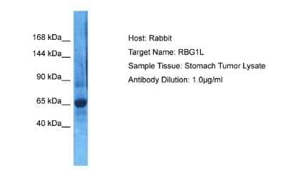 Western Blot: RABGAP1L Antibody [NBP2-85582]