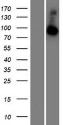 Western Blot: RABGAP1L Overexpression Lysate [NBP2-07261]