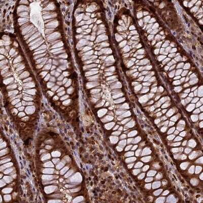 Immunohistochemistry-Paraffin: RABGGTA Antibody [NBP1-87197]