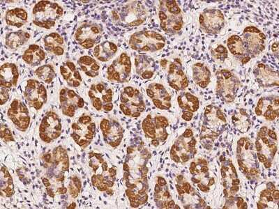 Immunohistochemistry-Paraffin: RABGGTA Antibody [NBP2-97779]