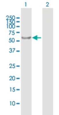 Western Blot: RABGGTA Antibody [H00005875-B01P]