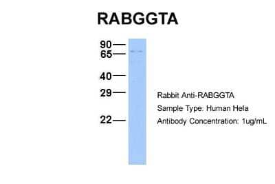 Western Blot: RABGGTA Antibody [NBP1-55183]
