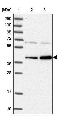 Western Blot: RABGGTA Antibody [NBP1-87197]