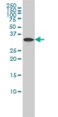 Western Blot: RABGGTB Antibody (1C2) [H00005876-M02]