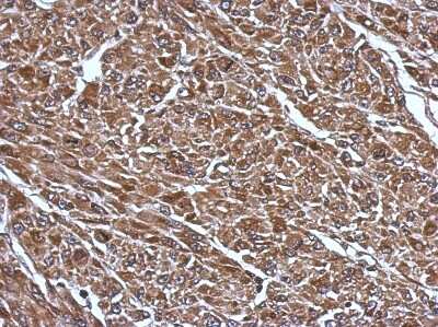 Immunohistochemistry-Paraffin: RABGGTB Antibody [NBP2-20048]