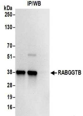 Immunoprecipitation: RABGGTB Antibody [NBP2-32214]