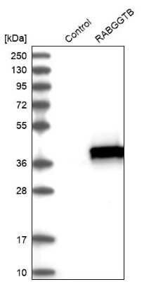 Western Blot: RABGGTB Antibody [NBP1-85957]