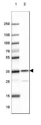 Western Blot: RABGGTB Antibody [NBP1-85962]