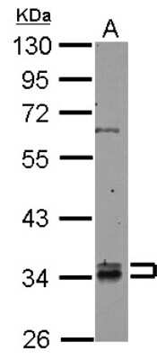 Western Blot: RABGGTB Antibody [NBP2-20048]
