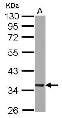 Western Blot: RABGGTB Antibody [NBP2-20048]