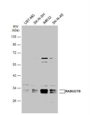 Western Blot: RABGGTB Antibody [NBP2-20048]