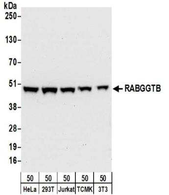 Western Blot: RABGGTB Antibody [NBP2-32214]