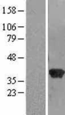 Western Blot: RABGGTB Overexpression Lysate [NBL1-15098]