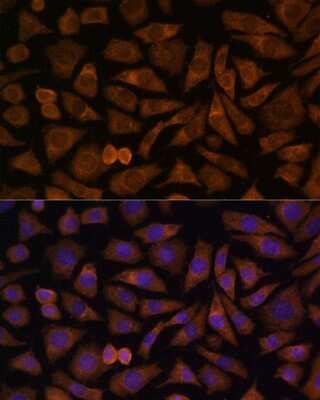 Immunocytochemistry/ Immunofluorescence: RABIF/MSS4 Antibody - Azide and BSA Free [NBP2-95169]