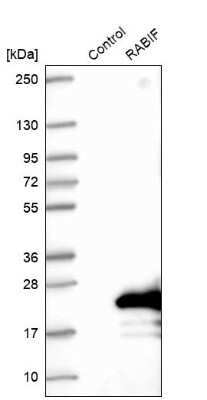 Western Blot: RABIF/MSS4 Antibody [NBP1-81024]