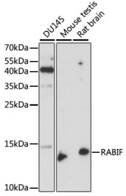 Western Blot: RABIF/MSS4 AntibodyAzide and BSA Free [NBP2-95169]