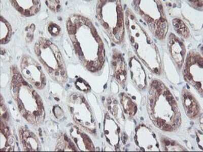 Immunohistochemistry: RABL2A Antibody (OTI4A3) [NBP2-45513]