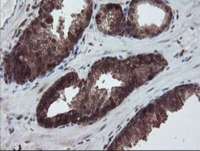 Immunohistochemistry: RABL2A Antibody (OTI4A3) [NBP2-45513]