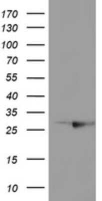 Western Blot: RABL2A Antibody (OTI4A3) [NBP2-45513]