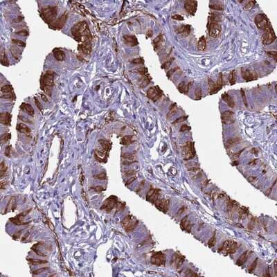 Immunohistochemistry-Paraffin: RABL2A Antibody [NBP2-46681]