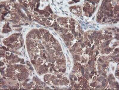 Immunohistochemistry: RABL2A Antibody (OTI4A3) - Azide and BSA Free [NBP2-73777]