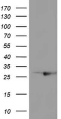 Western Blot: RABL2A Antibody (OTI4A3)Azide and BSA Free [NBP2-73777]