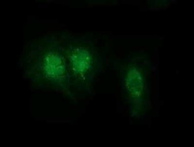 Immunocytochemistry/ Immunofluorescence: RABL2A Antibody (OTI4A8) - Azide and BSA Free [NBP2-73776]