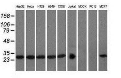 Western Blot: RABL2A Antibody (OTI4A8)Azide and BSA Free [NBP2-73776]