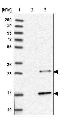 Western Blot: RABL2A Antibody [NBP2-46696]