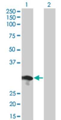 Western Blot: RABL2B Antibody (1B10) [H00011158-M01]