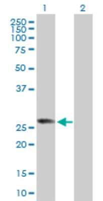 Western Blot: RABL2B Antibody [H00011158-D01P]