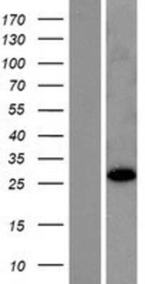 Western Blot: RABL2B Overexpression Lysate [NBP2-09526]