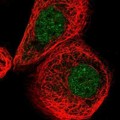 Immunocytochemistry/ Immunofluorescence: RABL3 Antibody [NBP2-33993]