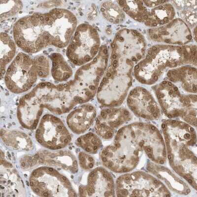 Immunohistochemistry-Paraffin: RABL3 Antibody [NBP1-81160]