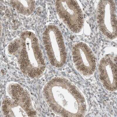 Immunohistochemistry-Paraffin: RABL3 Antibody [NBP1-81160]