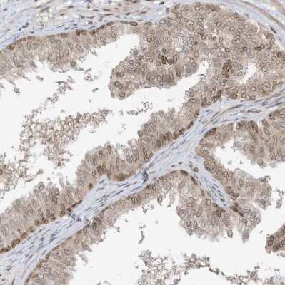 Immunohistochemistry-Paraffin: RABL3 Antibody [NBP1-81160]