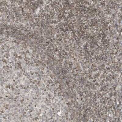 Immunohistochemistry-Paraffin: RABL3 Antibody [NBP1-81160]