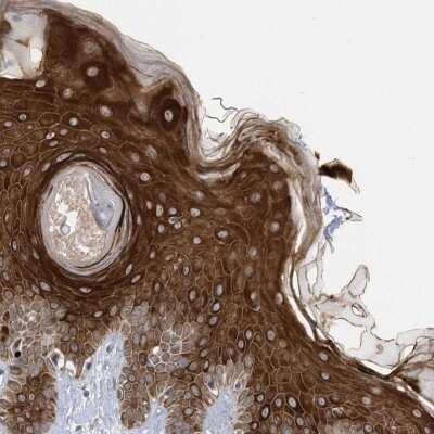 Immunohistochemistry-Paraffin: RABL3 Antibody [NBP2-33993]