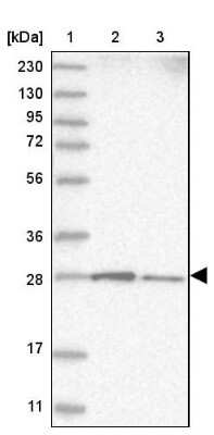 Western Blot: RABL3 Antibody [NBP1-81160]